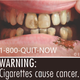 Image for article titled All the Disgusting Pictures the FDA Is Going to Put on Cigarette Boxes
